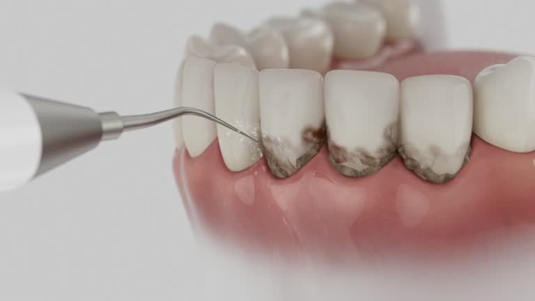 Trusted Wisdom Tooth Removal service in Quincy, FL - Dentist Open Now